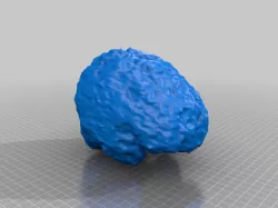 Brain