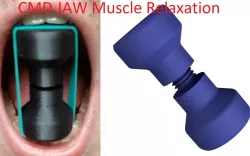 CMD Jaw Saver for Muscle Relaxation