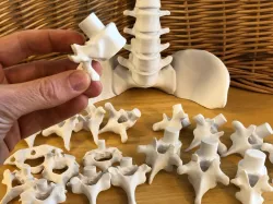 Vertebral Stacking Blocks