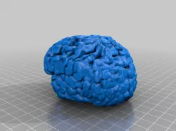 My Brain