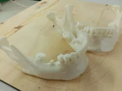 Human Mandible - Lower Jaw Bone (Gender: Female)