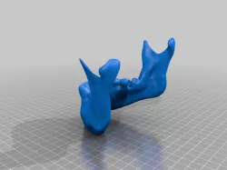 Mandible - Lower Jaw Bone