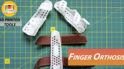 Finger orthosis
