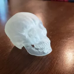 CT Skull Scan