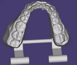 ARTICULATED LOWER DENTAL MODEL, ARTICULATED LOWER DENTAL MODEL