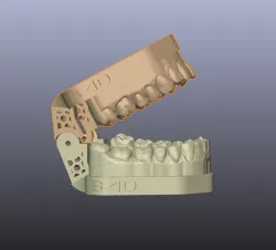Demonstrative models with verti articulator B4D