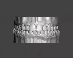 Dental model, mouth, teeth