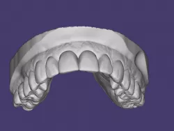 DENTAL MODEL UPPER, DENTAL MODEL UPPER