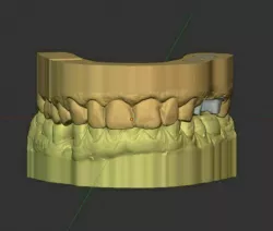 Dental Models DIES B4D