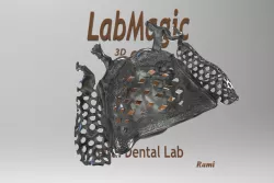 Digital RPD Frame (Partial Denture)