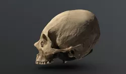 Human Skull Trepanation Photogrammetry 3D scan 3D model