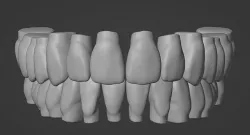 Maxillary and Mandibular dental models 3D 3D model