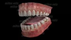 Teeth Denture Upper and lower Jaw with gums and tongue Low-poly 3D model