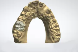 Dental model crown 3D model