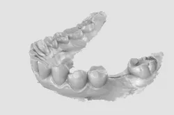 Human Lower Jaw Scan 3D model