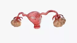 uterus and ovaries Low-poly 3D model