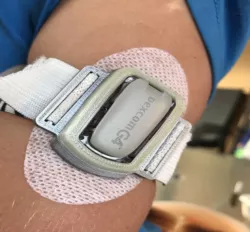 Dexcom G4/G5 cover