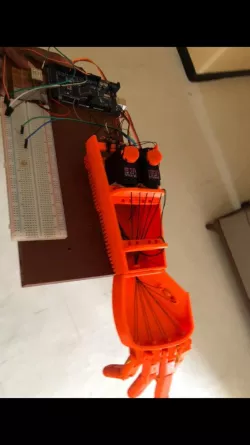 Prosthetic Arm