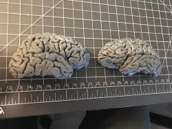 Human Brain Hemispheres from MRI data