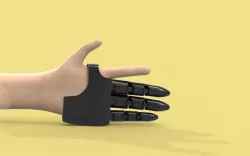 prosthetic finger