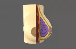 Medical Breast Model - printable 3D model