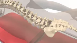 Spine Fixator