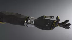 BİONİC ARM PROSTHESİS