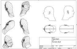 Human Skull meshing