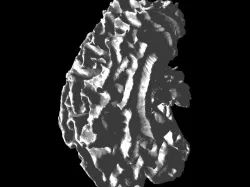 cerebral cortex white/gray matter boundary