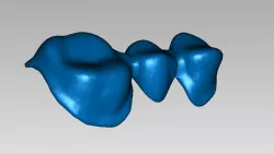 Teeth AAA
