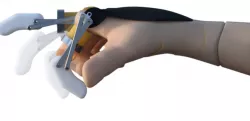 3D PRINTED PROSTHETIC FINGER