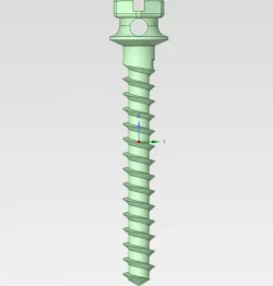 Jail dental implant