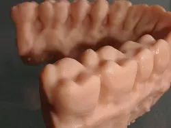 Maxilla Mandible from DICOM to STL