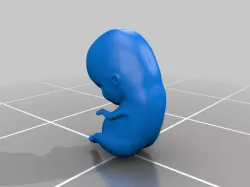 fetus