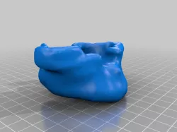 Maxillary Bone