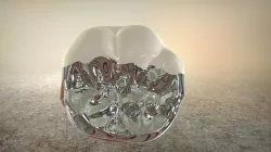 Dental Full Contour Crown & Veneer