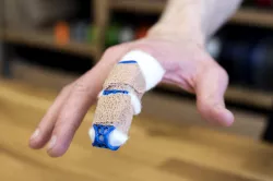 Finger Brace (splint)
