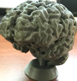 Brain