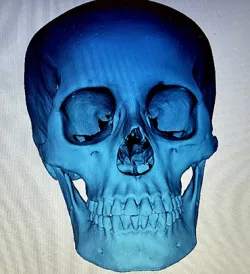  Cranium scanned