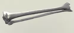 Human Tibia and Fibula