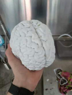 Human brain