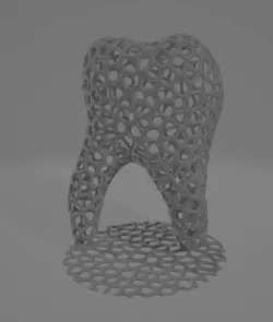 voroni molar with base