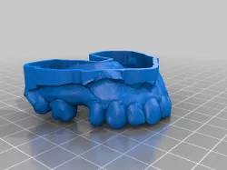 Dental Models