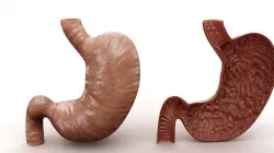  Stomach and Stomach Section 3D model