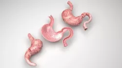 Stomach and Stomach Section 3D model