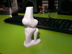 Knee joint