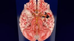 circle of willis 3d model | Page 1 | STLFinder