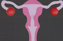 Uterus 3D model