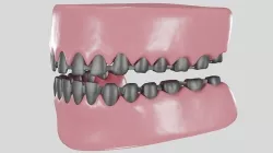 Metal ceramic mold 3D model