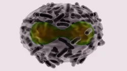 Monkeypox Virus smallpox viruela mono epidemic infection 3D model